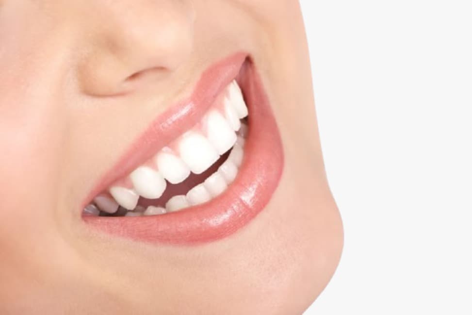Dental procedures