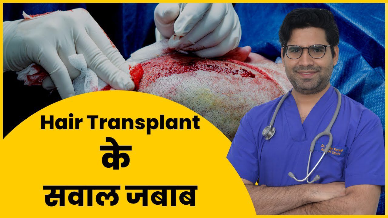 Q & A Hair Transplant in Hindi