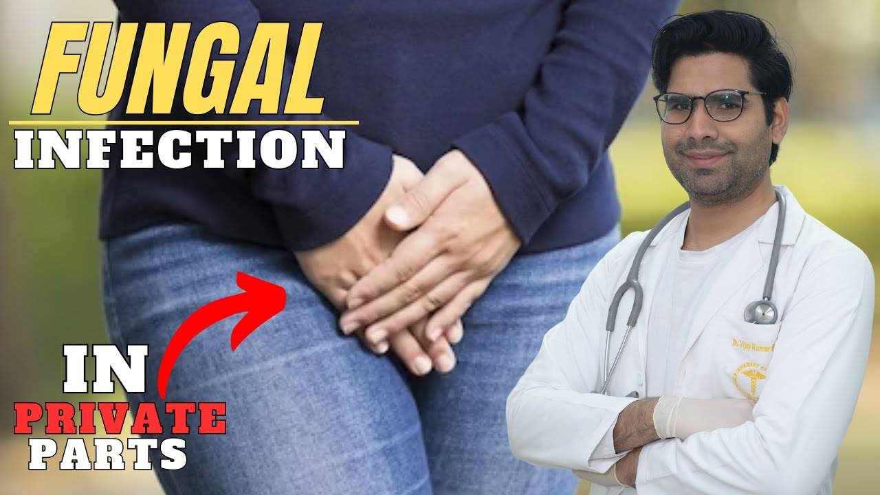 Fungal Infection