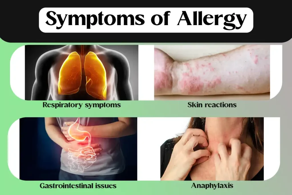 Symptoms of Allergy​
