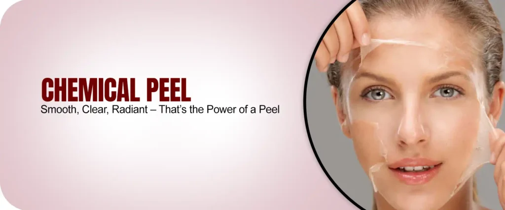 Chemical Peel for Brightening & Acne | AWISH Clinic Dermatology