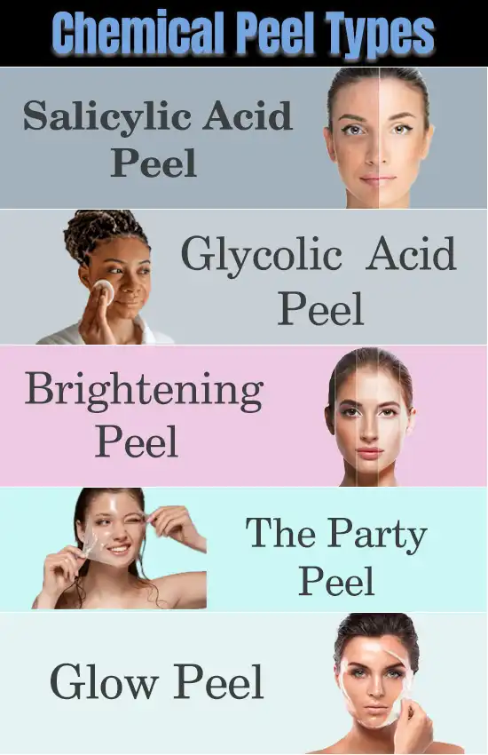Chemical Peel Types at AWISH Clinic